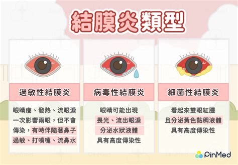 眼睛周圍紅腫|急性結膜炎原因？會傳染嗎？症狀、治療方式一次看